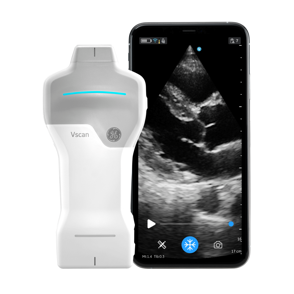 Vscan Air™ SL